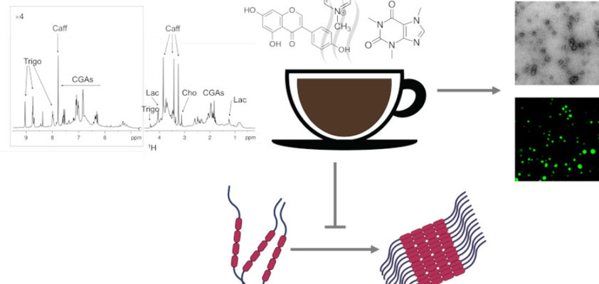 Verona Universiteti: Qəhvə Alzheimerə qarşı təsirlidir