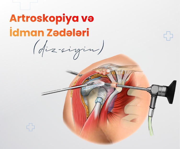 Artroskopik əməliyyat hansı zədələr üçün tətbiq edilir?