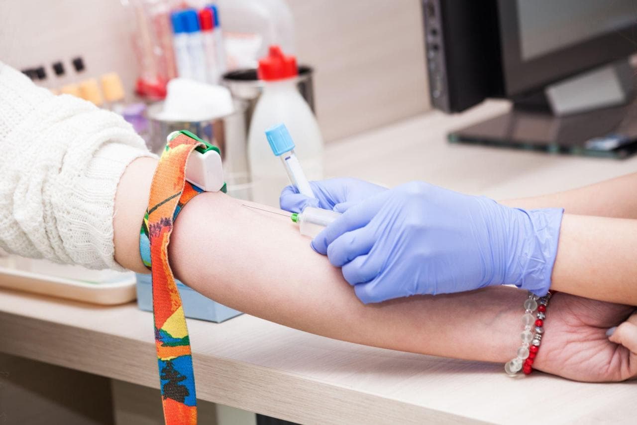 Bu simptomlar varsa, dərhal xolesterolunuzu yoxladın!