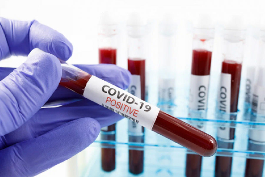 Britaniyada onlarla mutasiyaya malik yeni koronavirus variantı aşkarlanıb