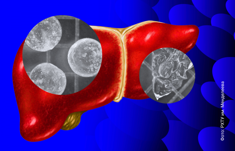 Qaraciyər üçün “protez” - Sirrozu sağaldacaq