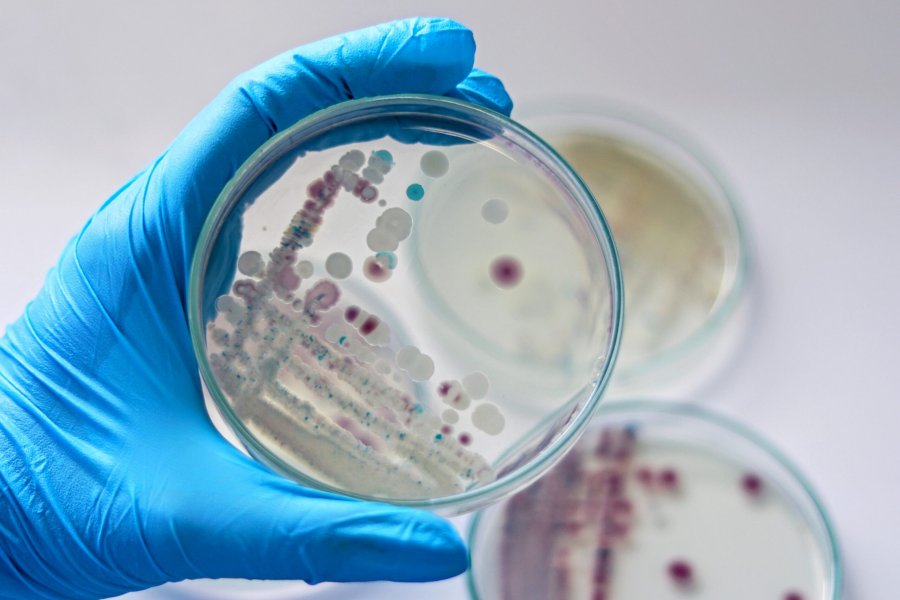 Epidemioloq ölümcül bakteriyadan danışıb