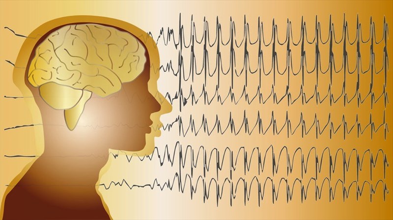 Epilepsiya hər il dünyada təxminən 2,4 milyon insana təsir edir