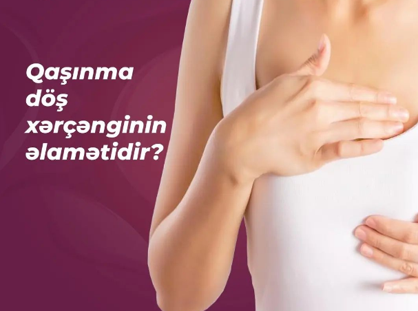 Qaşınma döş xərçənginin əlamətidir? Onkoloq izah etdi