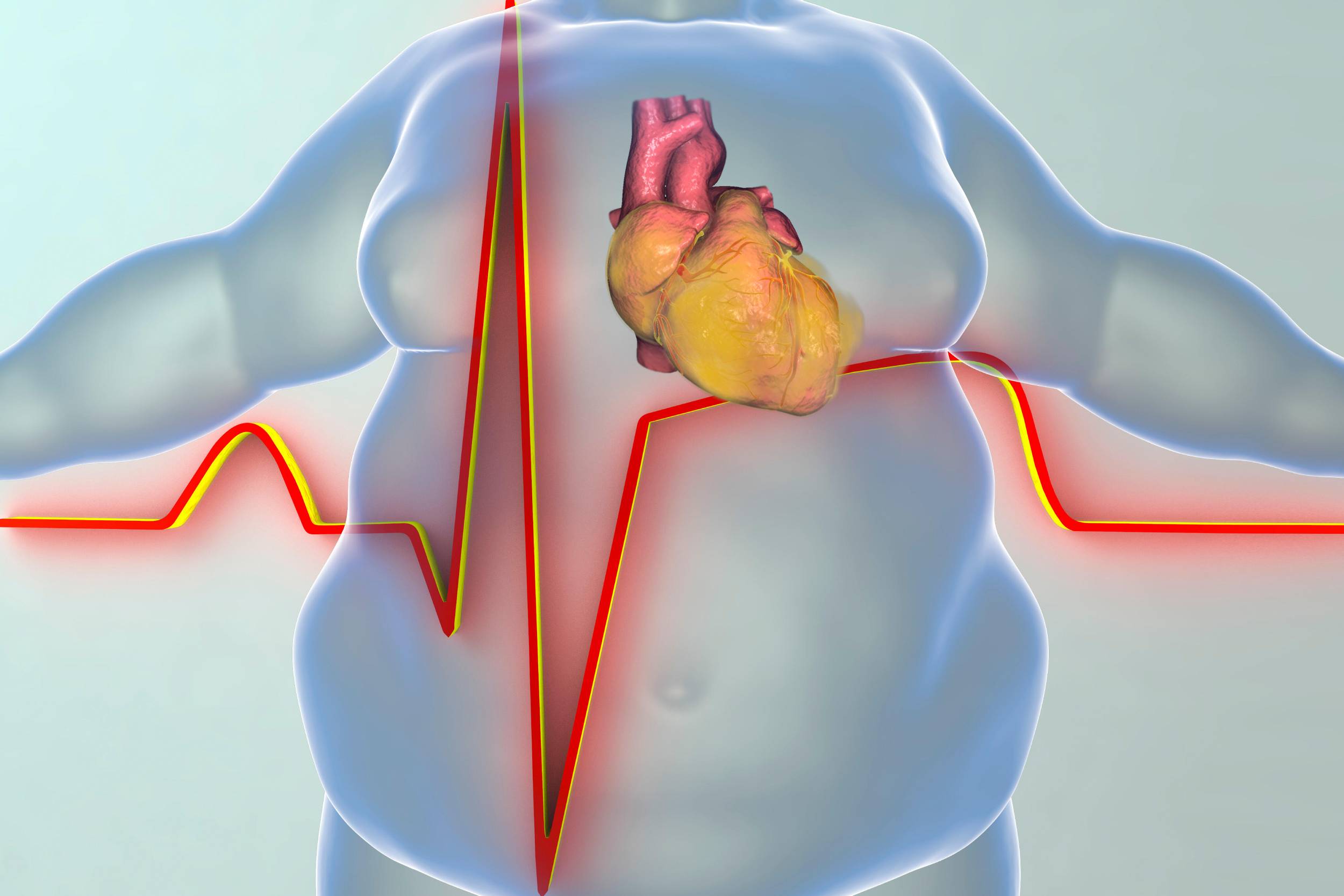 Artıq bədən çəkisinin ürək-damar sisteminə təsirləri nələrdir? - İnvaziv kardioloq AÇIQLADI