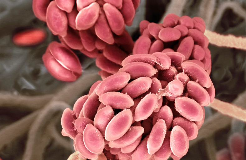 Tarixdə ilk - Həkimlər insanda göbələyə yoluxma halını qeydə alıblar