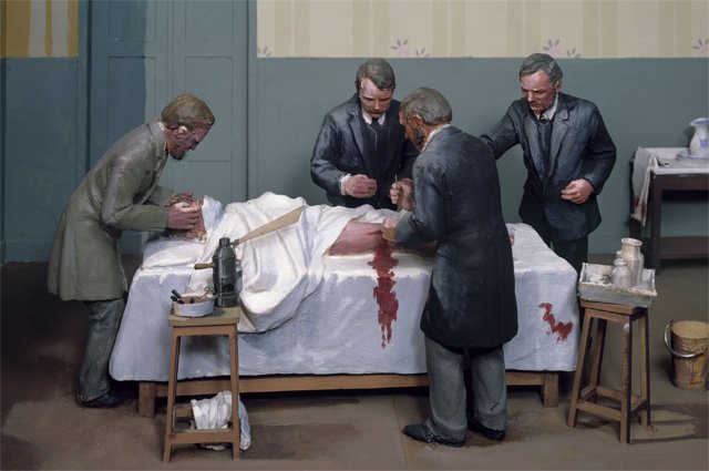 Sağlamlığın açarı - antiseptiklərin yaranma tarixi. Gərgin alim əməyi, qurbanlar - Birinci yazı