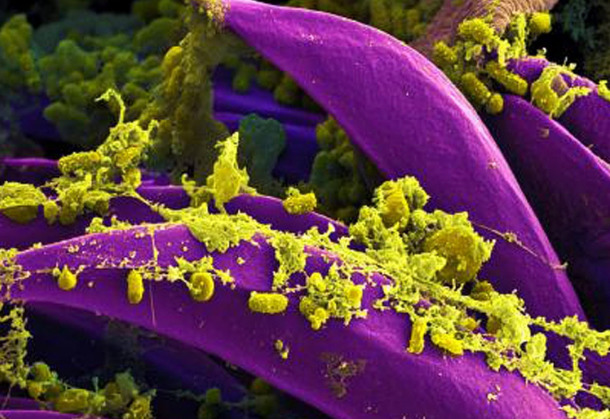 Yerin dərin hissəsində maqnetotaktik bakteriyalar tapılıb