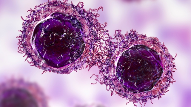 Süni intellektin tətbiqi ilə bu xərçəngin mərhələləri anında bilinəcək