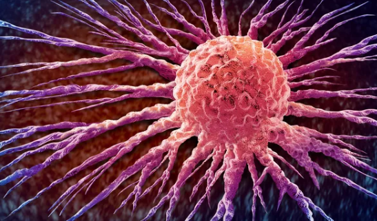 Həkim xərçəngin erkən mərhələlərində aşkarlanmasına kömək edəcək testləri sadalayıb