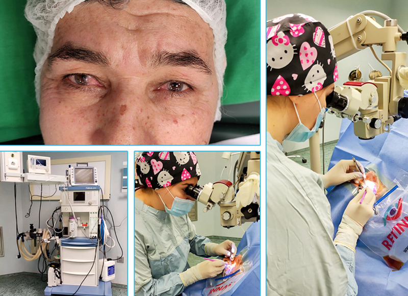  Xızı Rayon Mərkəzi Xəstəxanasında göz əməliyyatlarına start verilib     