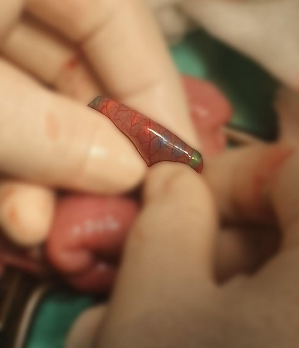 Yad cisim udan azyaşlının həyatı xilas edilib