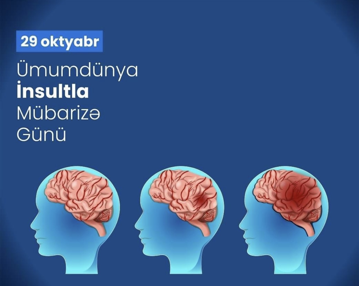 29 oktyabr – Ümumdünya İnsultla Mübarizə Günüdür