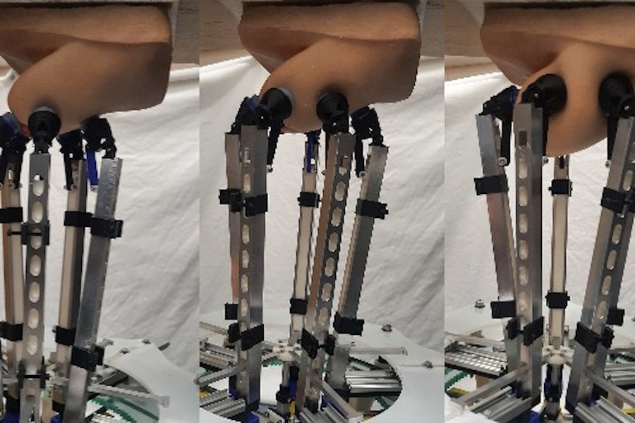 Yeni manipulyator qadınlarda döş xərçəngi şişlərini dəqiq aşkarlaya bilir