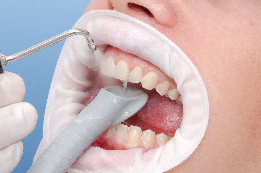 Diabet dərmanı periodontal xəstəliyi və diş əti xəstəliklərini effektiv şəkildə müalicə edir