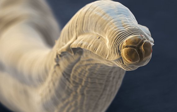 Tükbaş qurdu - Yoluxmuş adamlarda hansı əlamətlər görülür?