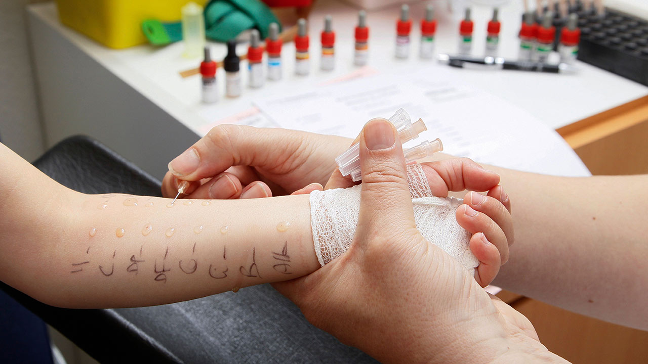 FOX Qida Həssaslığı Testi - Şikayətlərdən azad olacaqsınız