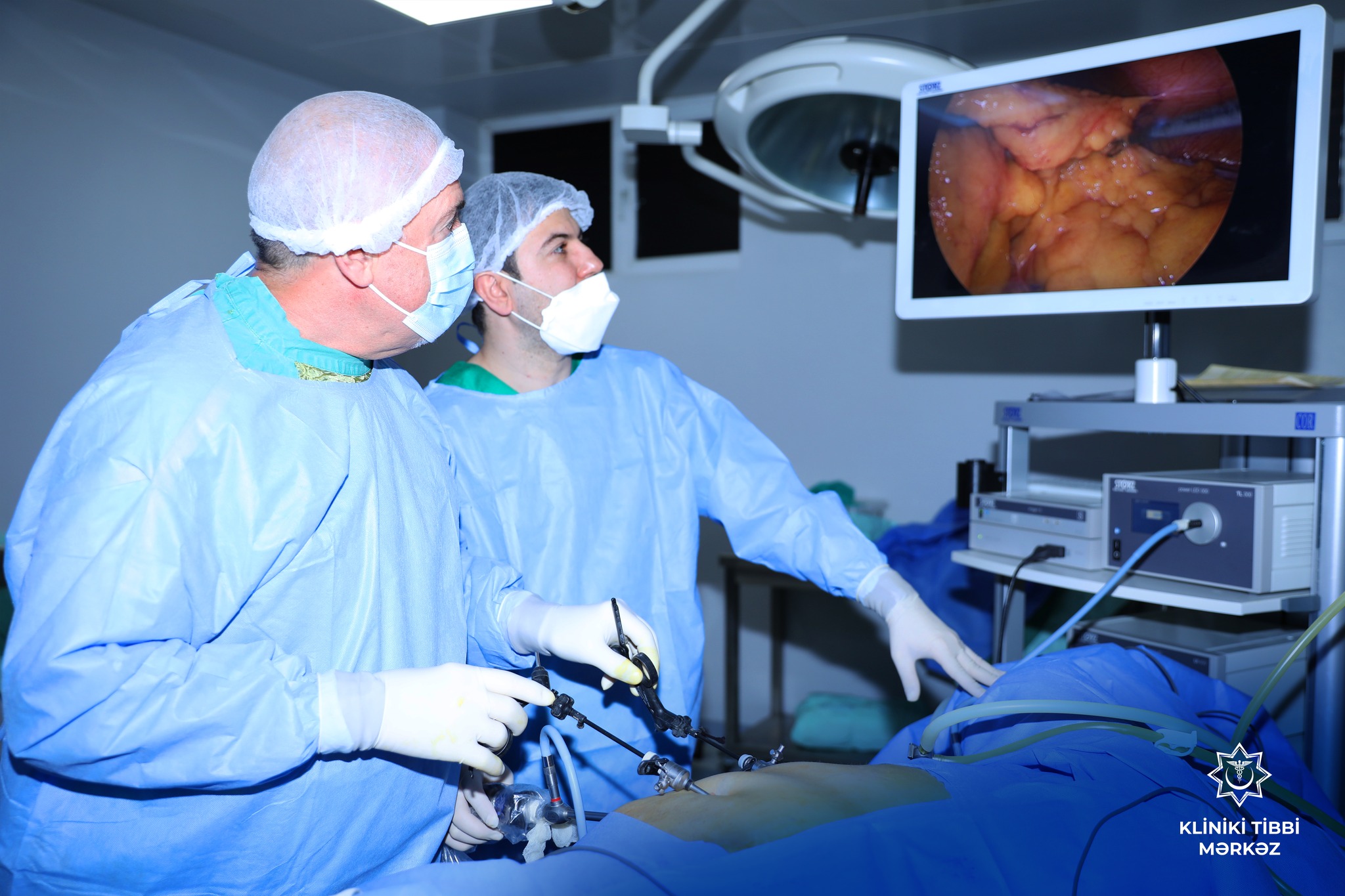  Kliniki Tibbi Mərkəzdə 60 yaşlı xəstə üzərində laparoskopik əməliyyat icra edilib   