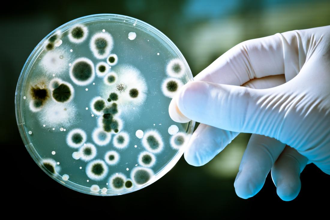 Həkim: Mikroorqanizmlər artıq antibiotiklərdən qorxmayır