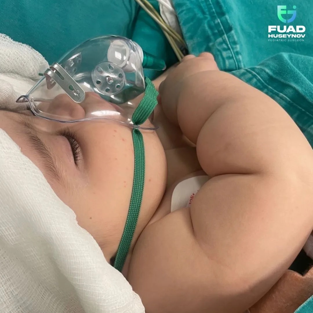 Bacısının plastik dırnağını udan 6 aylıq uşaq Mərkəzi Klinikada əməliyyat olunub