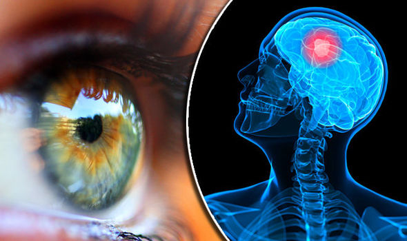 
Gözlərdə kəskin ağrı beyində şiş olduğunu göstərə bilər
