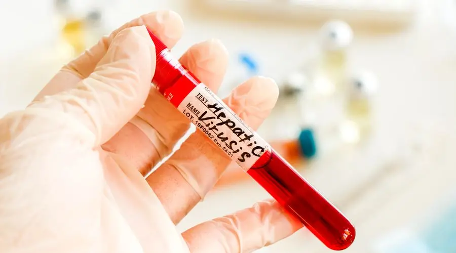 ÜST: Hepatit B və C infeksiyaları səbəbindən hər gün 3500 insan ölür
