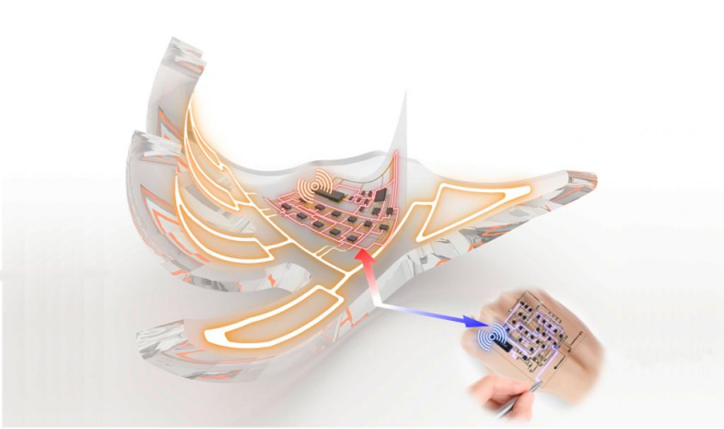 Çin alimləri güclü şaxtaya dözümlü “elektron dəri” yaradıblar