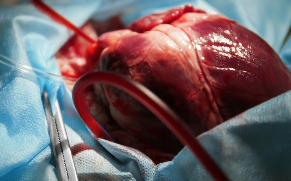 2021-2023-cü illər ərzində Azərbaycanda icbari tibbi sığorta hesabına 8153 aorta-koronar şuntlama əməliyyatı icra olunub