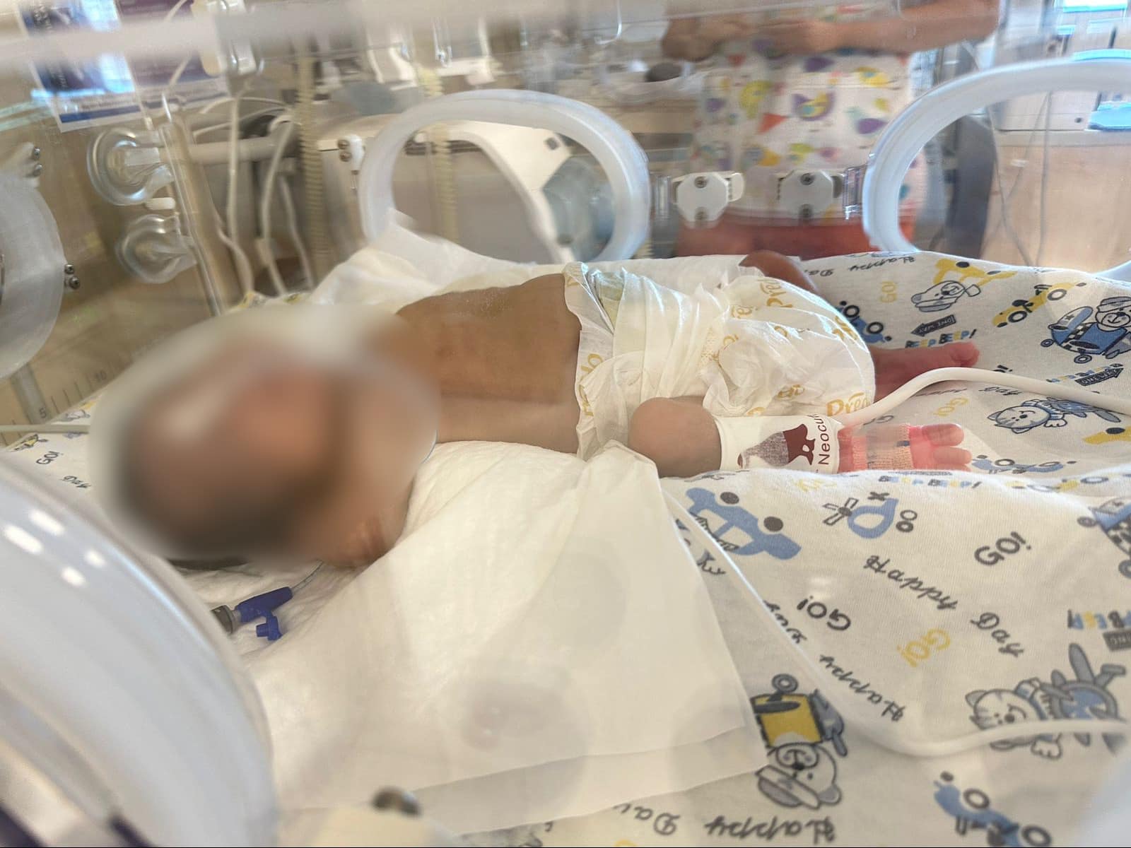  Yeni Klinika komandası 26-cı həftəsində doğulan körpənin həyatını xilas etdi   