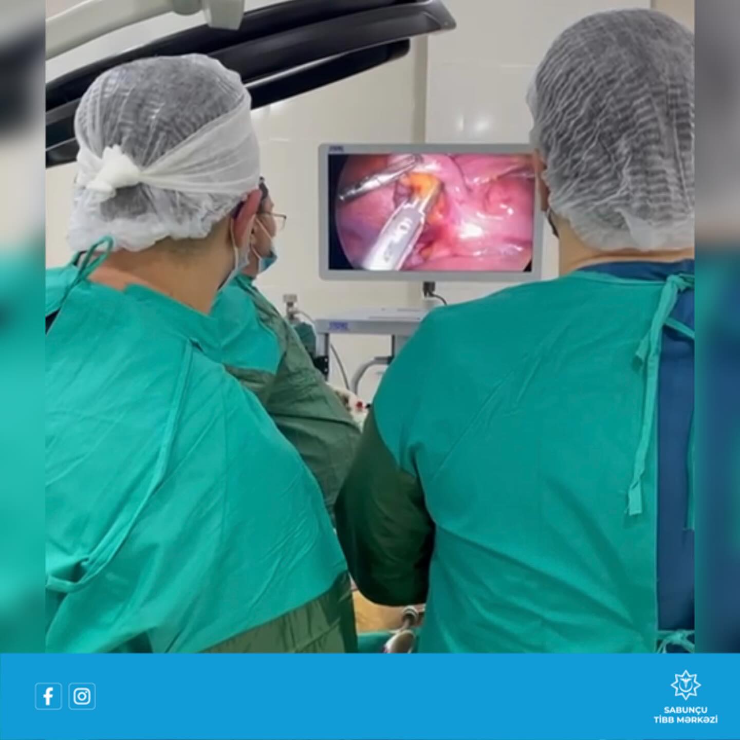 Sabunçu Tibb Mərkəzində laporoskopik appendektomiya əməliyyatı icra edilib