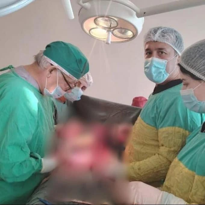  Tovuz Rayon Mərkəzi Xəstəxanasında mədə rezeksiyası əməliyyatı icra olunub   