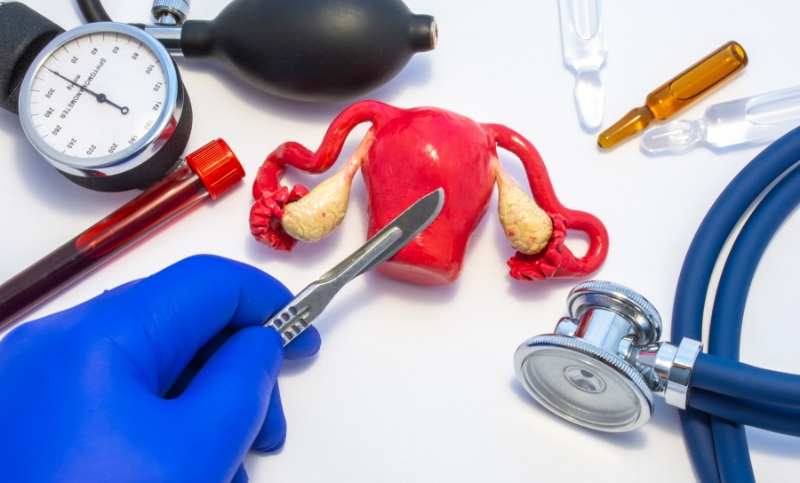 Histerektomiya nədir? Hansı hallarda icra olunur?