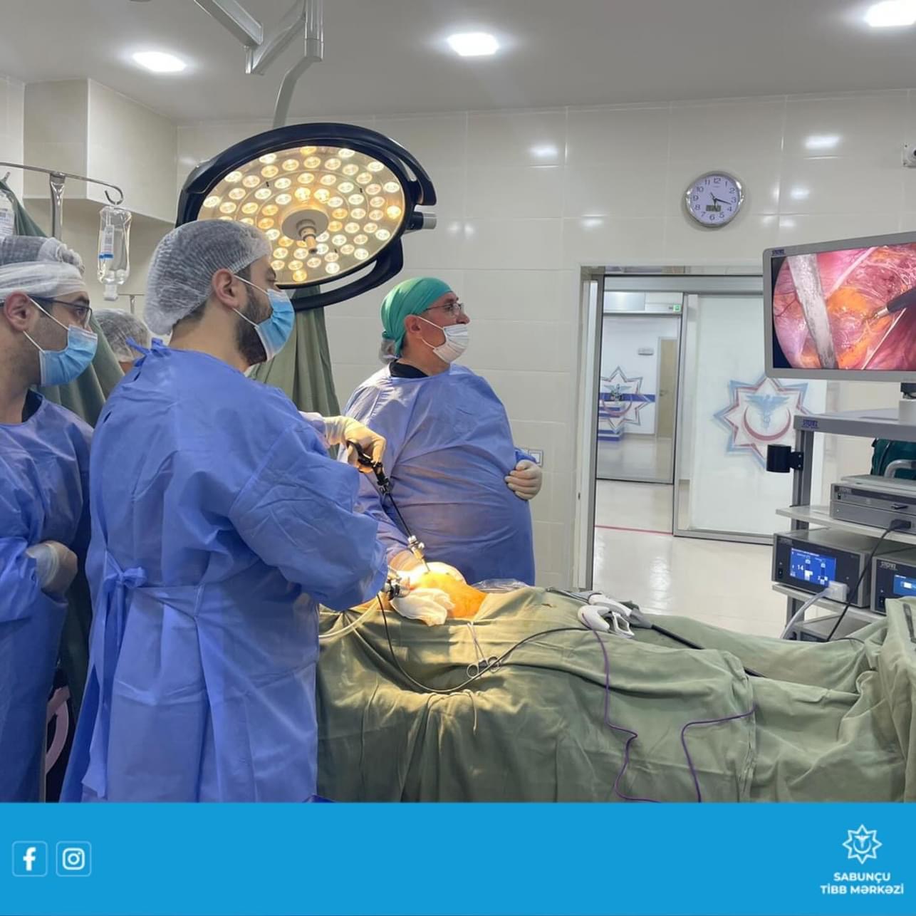 Sabunçu Tibb Mərkəzində ilk dəfə laporoskopik herniotomiya əməliyyatı icra edilib