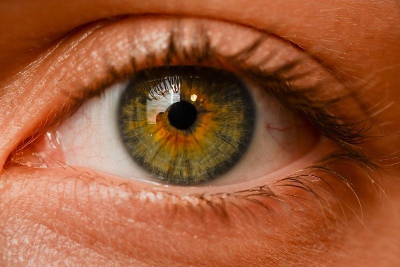 Stress quru göz problemlərini daha da pisləşdirə bilər