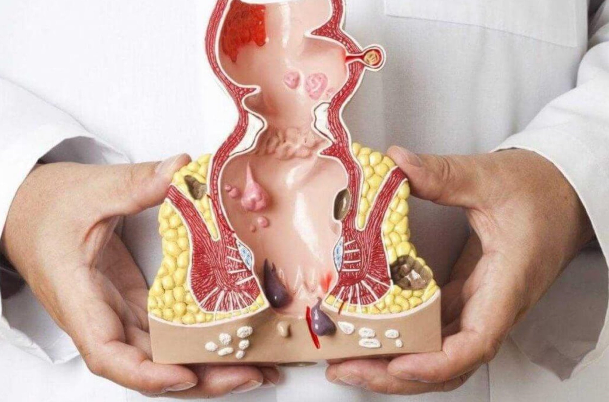 İcbari tibbi sığorta ilə babasilin müalicəsi 6 metodla qarşılanır