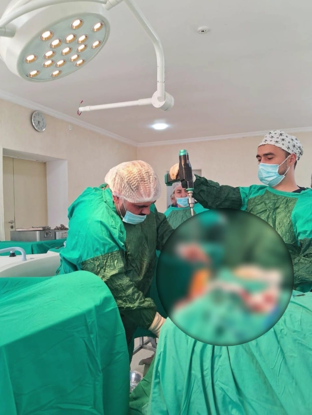  Şirvan Şəhər Mərkəzi Xəstəxanasında daha bir uğurlu əməliyyat icra olunub   