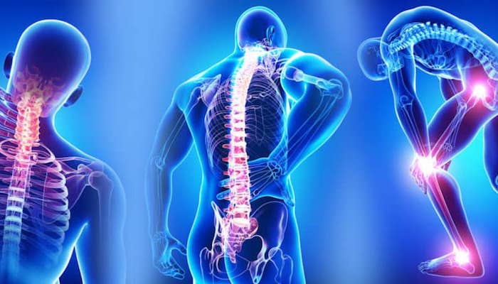  Fibromiyalgiya sindromu: Səbəbləri və simptomları