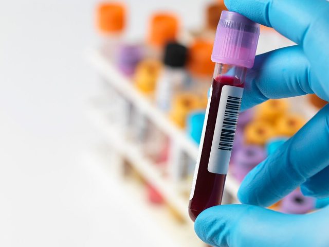 Hər 5 ildən bir qanda ümumi xolesterol səviyyəsi yoxlanılmalıdır