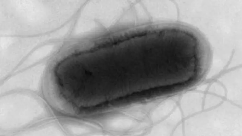 İngiltərədə qidada E.coli epidemiyası: 113 yoluxma hadisəsi qeydə alınıb