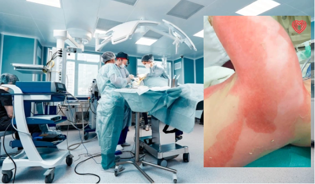 Smartfonun şarj cihazından yanıq xəsarətləri alan uşaq xilas edilib