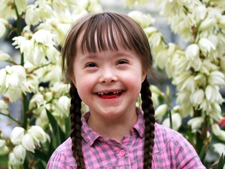 Martın 21-i Beynəlxalq Daun Sindromlu İnsanlar Günüdür