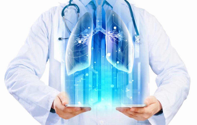 Süni intellekt ağciyər xərçəngini həkimlərdən dörd ay əvvəl aşkarlaya bilib  