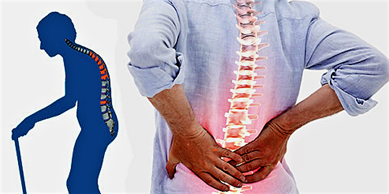  Osteoporoz nədir?   
