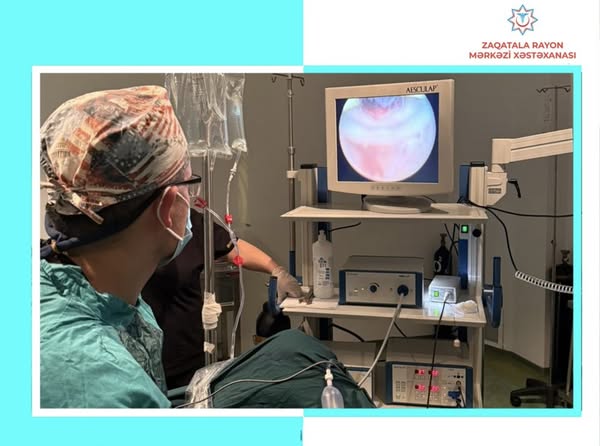 Zaqatala RMX-da ilk dəfə olaraq endoskopik əməliyyat icra olunub