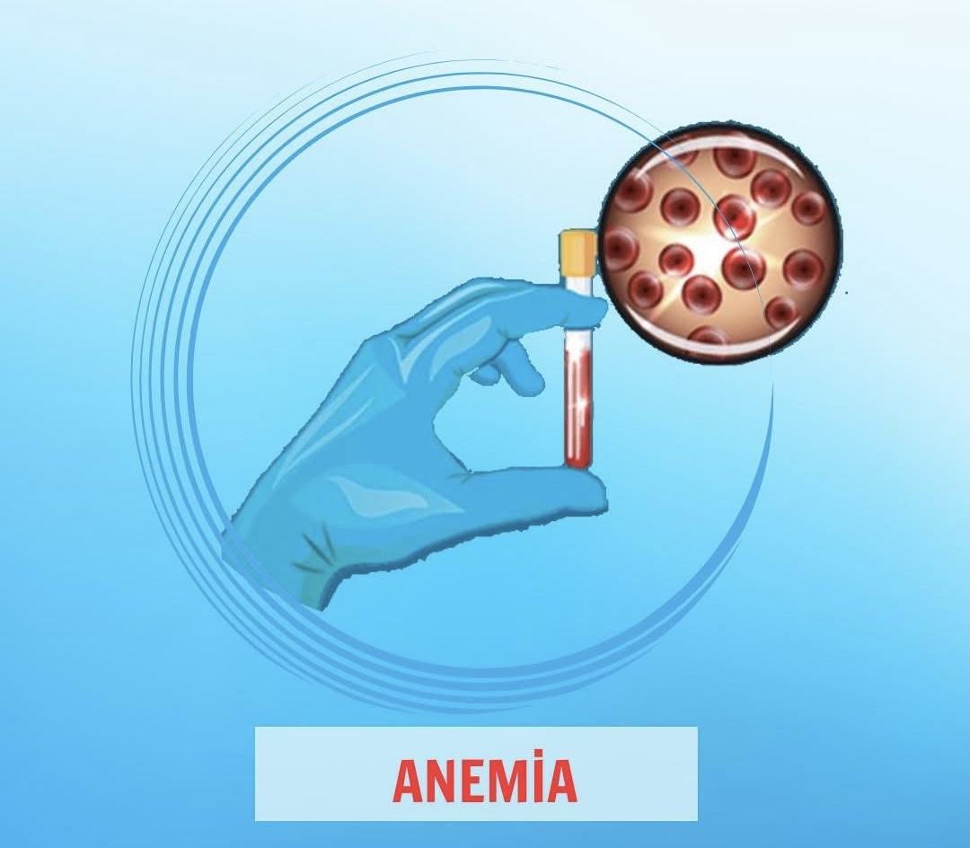 Anemiya nədir və niyə yaranır?