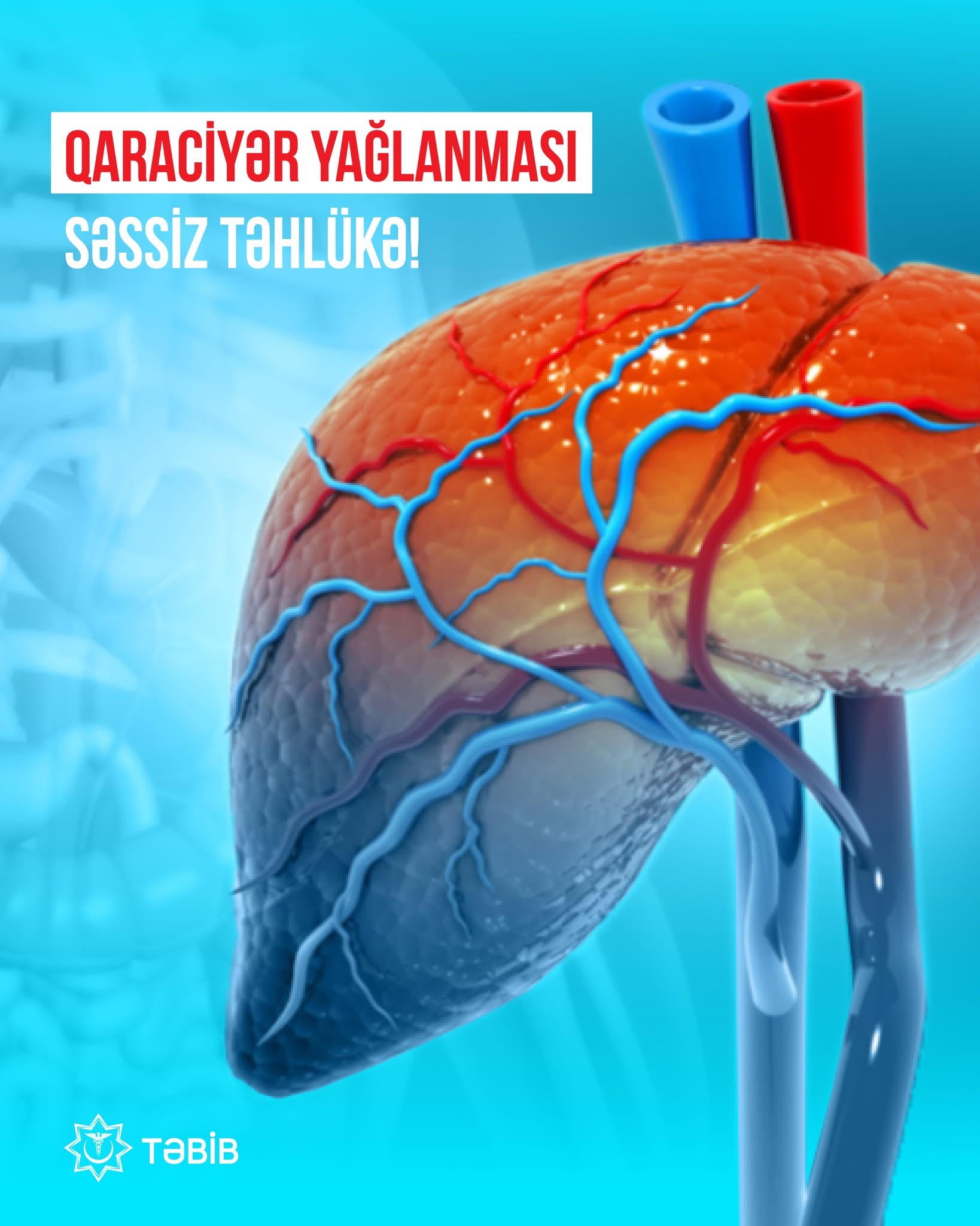 Qaraciyər yağlanması son illərdə gənclər arasında artan ciddi sağlamlıq problemidir