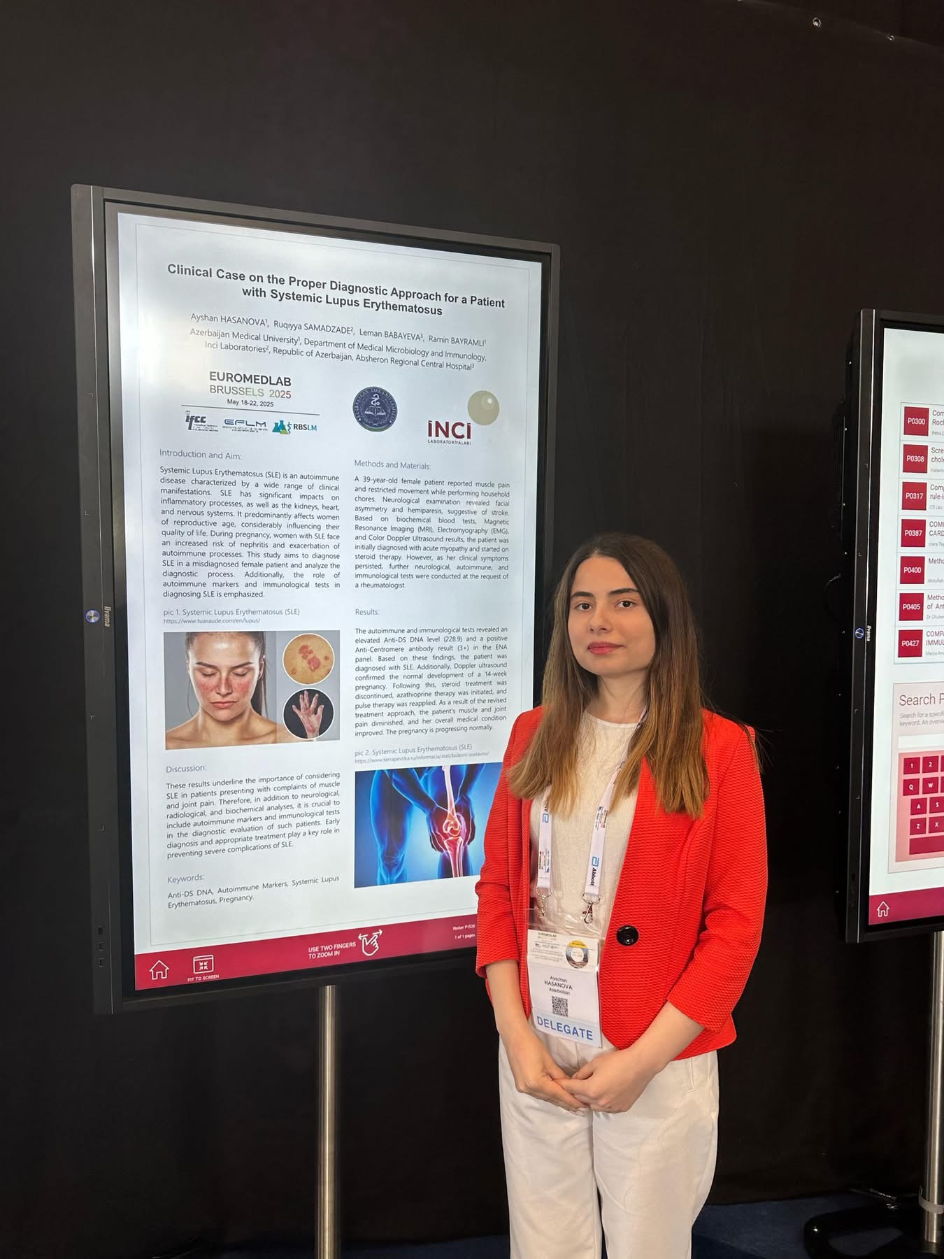 ATU-nun rezidenti beynəlxalq konqresdə sertifikatla tətlif olunub