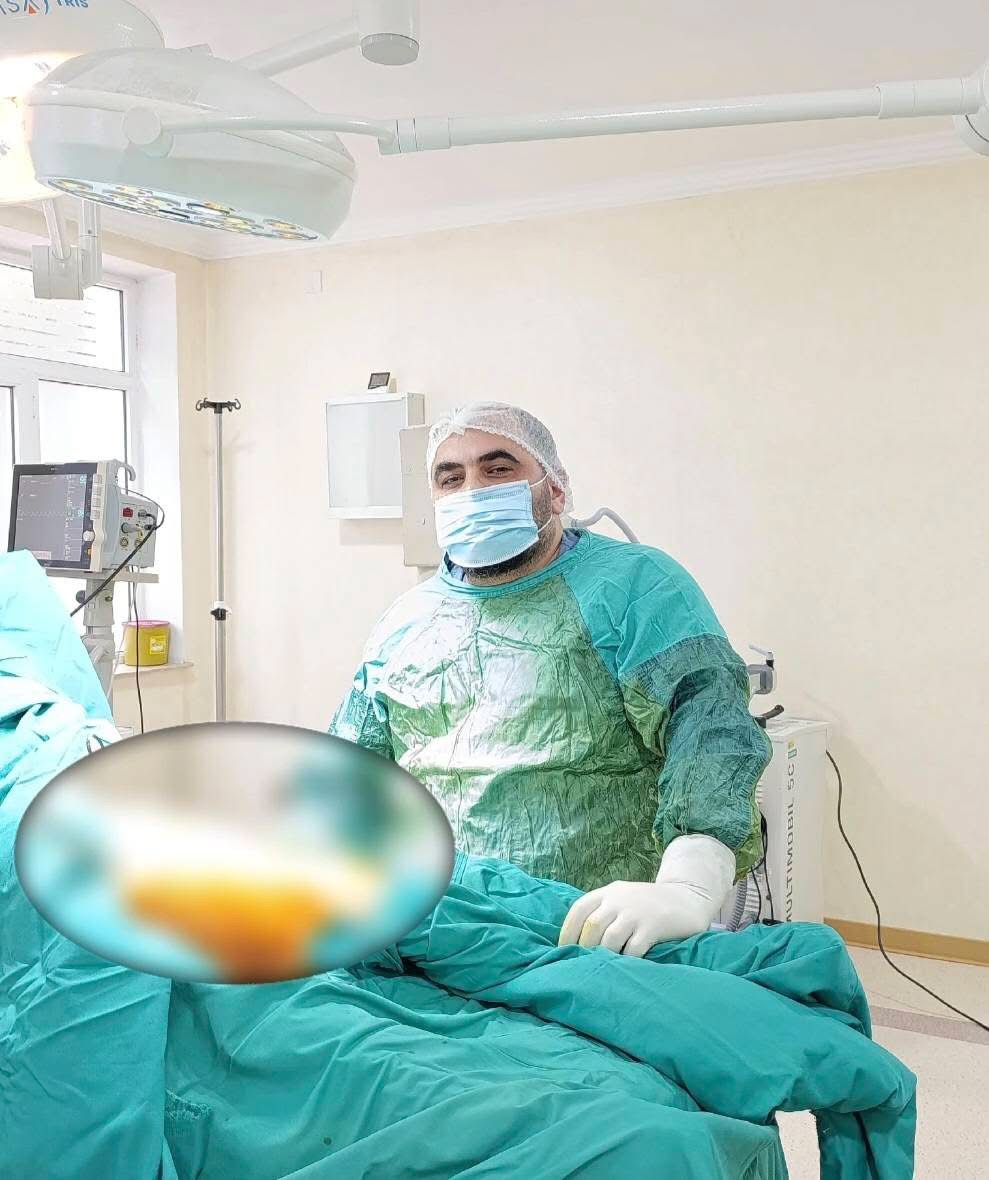 Şirvan ŞMX-da şəhid atasının üzərində icra olunan iki əməliyyat uğurla başa çatıb  