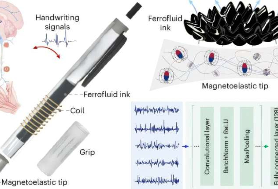 Parkinson xəstəliyinin erkən aşkarlanması üçün yüksək dəqiqlikli diaqnostik qələm hazırlanıb