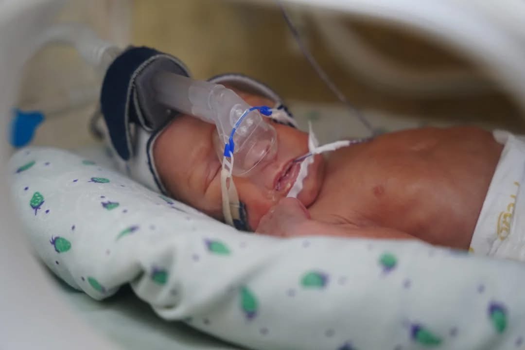 Quba Regional Perinatal Mərkəzində ana və 29 həftəlik doğulan körpənin həyatı xilas edilib